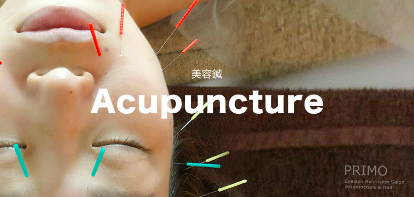 美容鍼